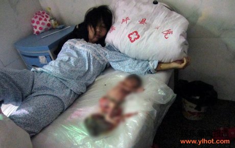 孕妇术后躺在医院中